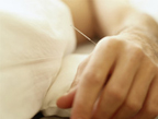 Bellingham Acupuncture FAQ