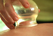 cupping-chinese-therapy-bellingham