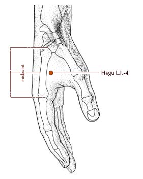 Headache Cures Bellingham