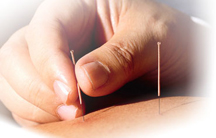 Acupuncture Whatcom County WA